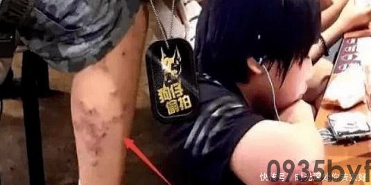 异位性皮炎是什么意思