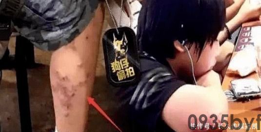 异位性皮炎怎么治疗