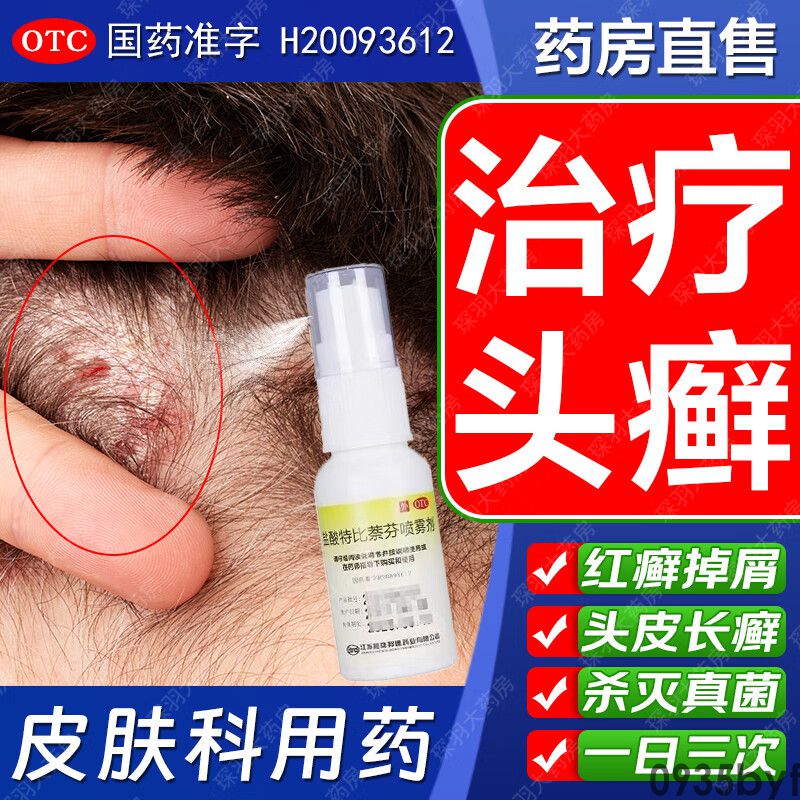 红斑癣怎么治疗