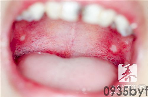 口腔异味使用什么牙膏(图2)
