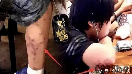 脚臭味是什么气体(图1) 脚臭味是什么气体