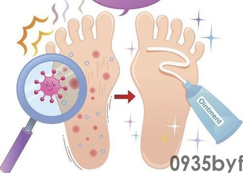 水泡型脚气能自愈吗?(图1) 水泡型脚气能自愈吗?