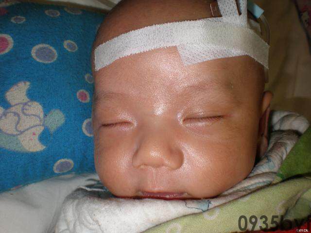 常见皮肤疾病典型图片汇总(图5) 常见皮肤疾病典型图片汇总(图5)