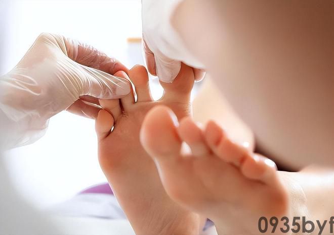 我国脚气患者过亿“祸根”被揪出:这些东西是脚气最大的帮凶(图1) 我国脚气患者过亿“祸根”被揪出:这些东西是脚气最大的帮凶(图1)