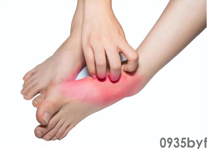 我国脚气患者过亿“祸根”被揪出:这些东西是脚气最大的帮凶(图3) 我国脚气患者过亿“祸根”被揪出:这些东西是脚气最大的帮凶(图3)