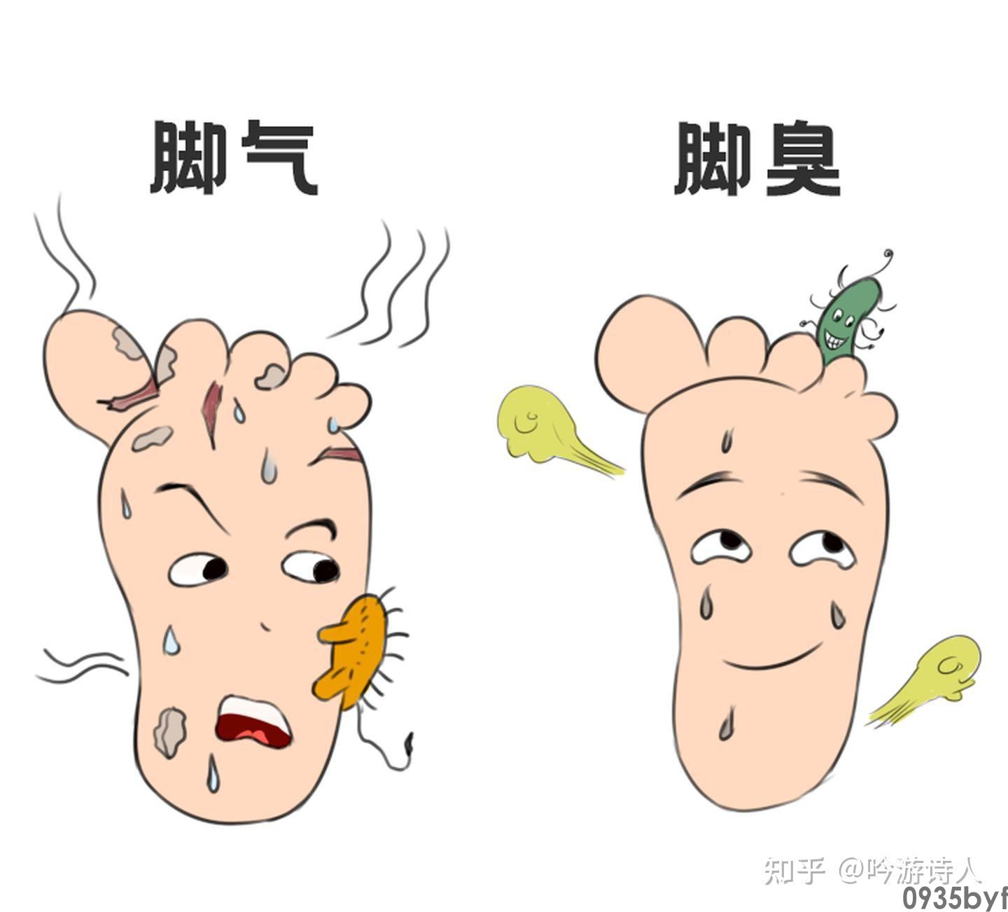 治疗脚气脚臭有什么好办法?(图1) 治疗脚气脚臭有什么好办法?