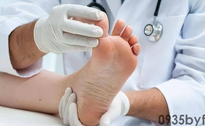 我国脚气患者上亿人这些东西才脚气的“祸根”!(图4) 我国脚气患者上亿人这些东西才脚气的“祸根”!(图4)