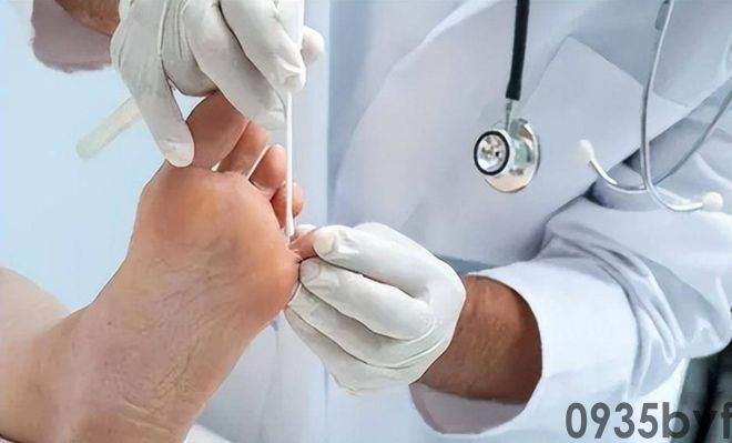 我国脚气患者上亿人这些东西才脚气的“祸根”!(图10) 我国脚气患者上亿人这些东西才脚气的“祸根”!(图10)