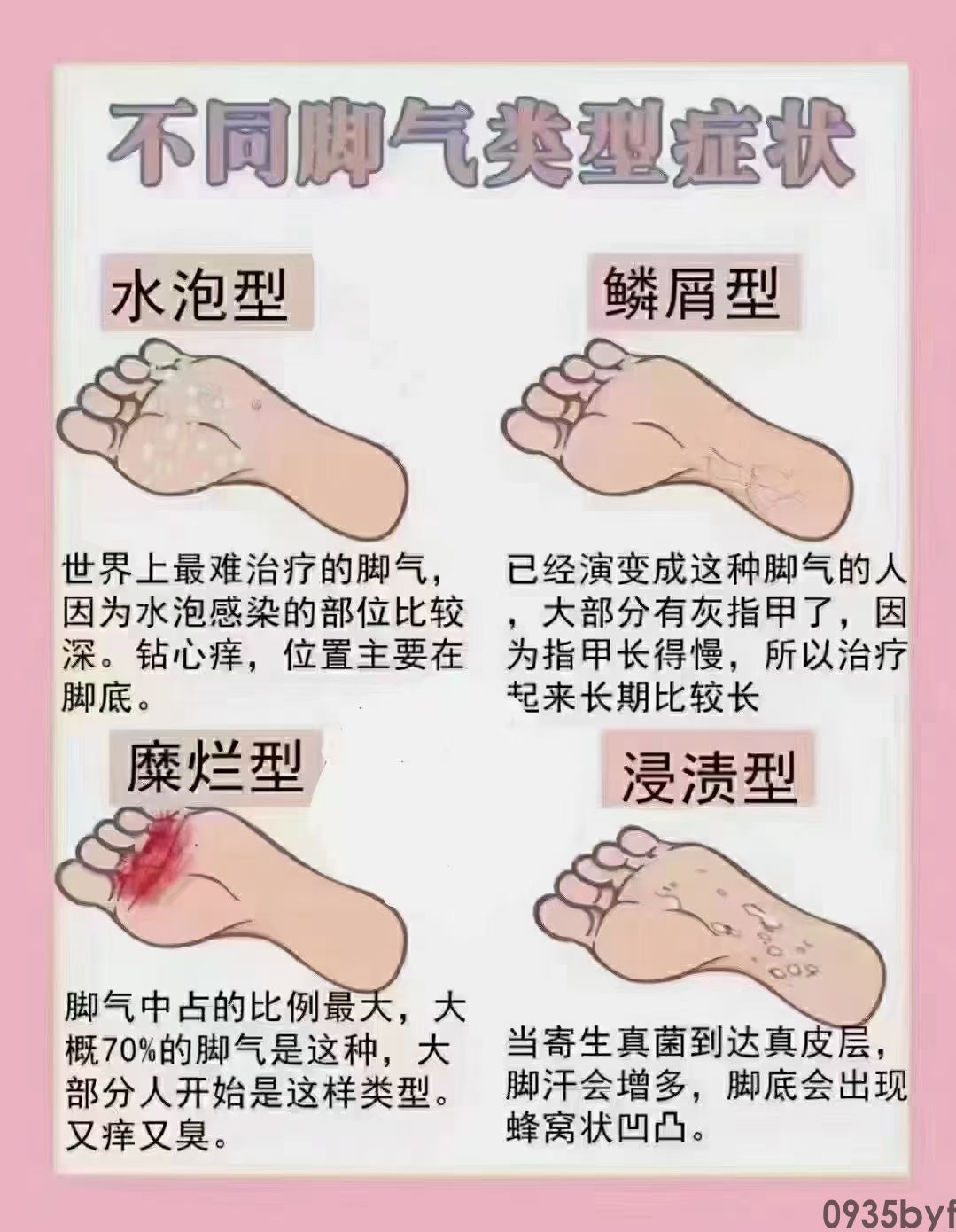 脚气药品牌大全