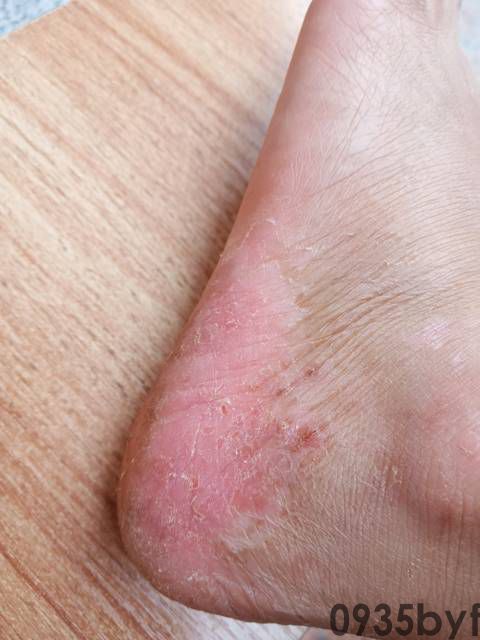 千万不能忽视！这款防脚臭抗菌袜竟然让我的生活焕然一新！