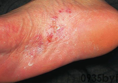 皮肤问题不再难辨识！20种常见皮肤病症状图谱大公开