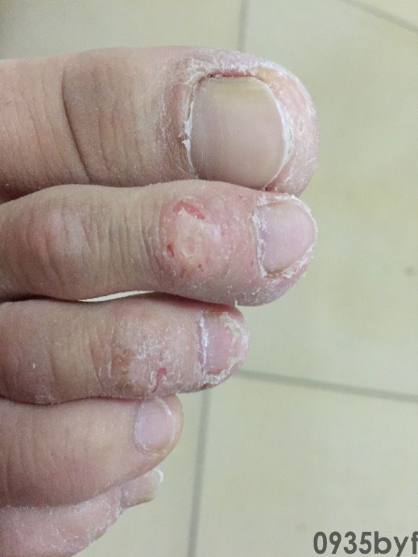 因为嘴太臭我真的去看了…