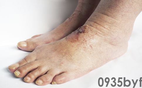 【1024·提醒】内衣袜子混洗男子确诊感染医生：这三件事要特别注意