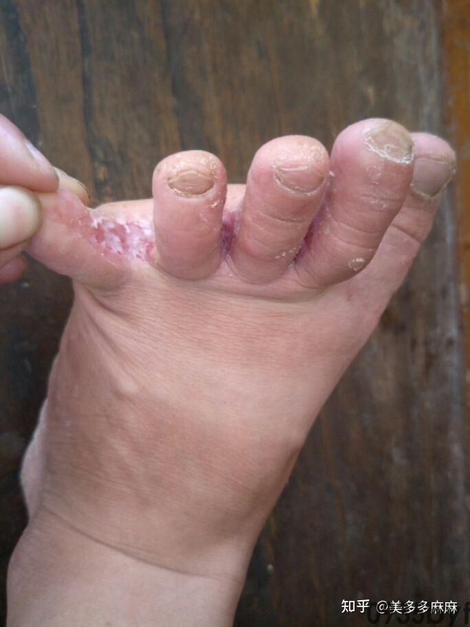 苦梨文集-傲娇女神