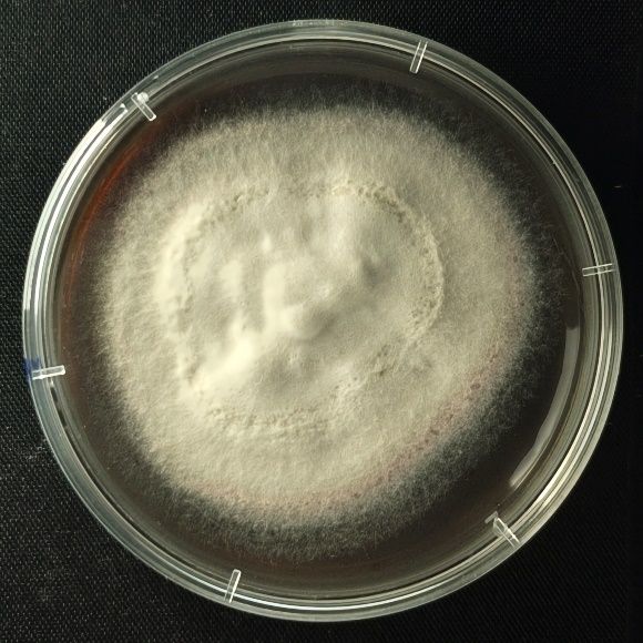 脚气为何反重复复总欠好？能够你踩这些“坑”里了！(图1)