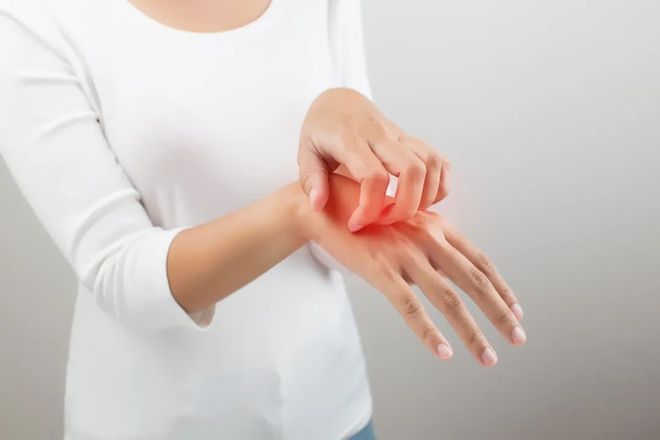 这3种夏日多发皮肤病许多人痒到受不了！快自查→（附止痒攻略）(图1)