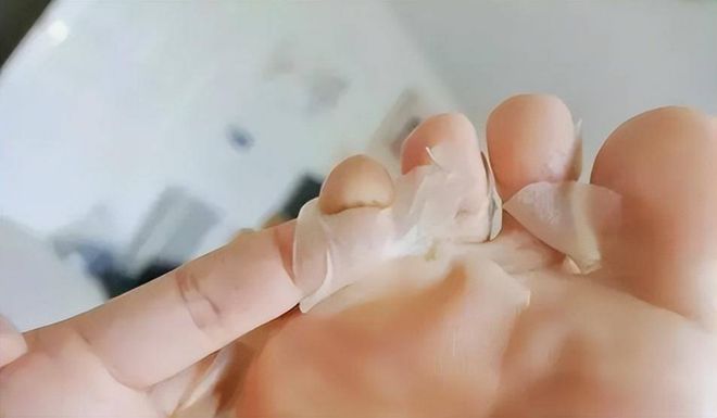 我国脚气患者上亿人这些工具才脚气的“祸端”！(图7)