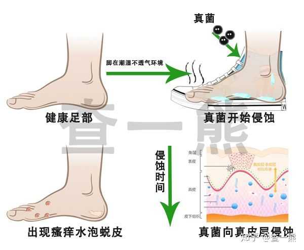 脚气真菌的生命周期