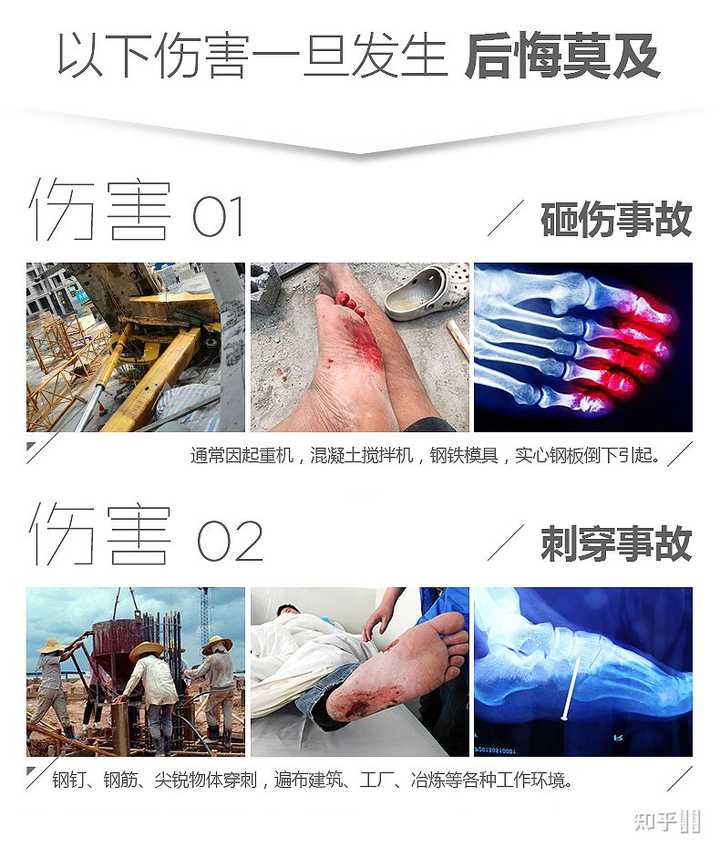 封闭工作鞋引发脚痒