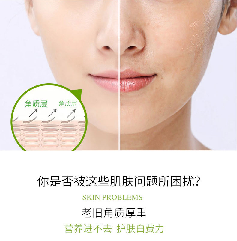 死皮堆积异味深层改善