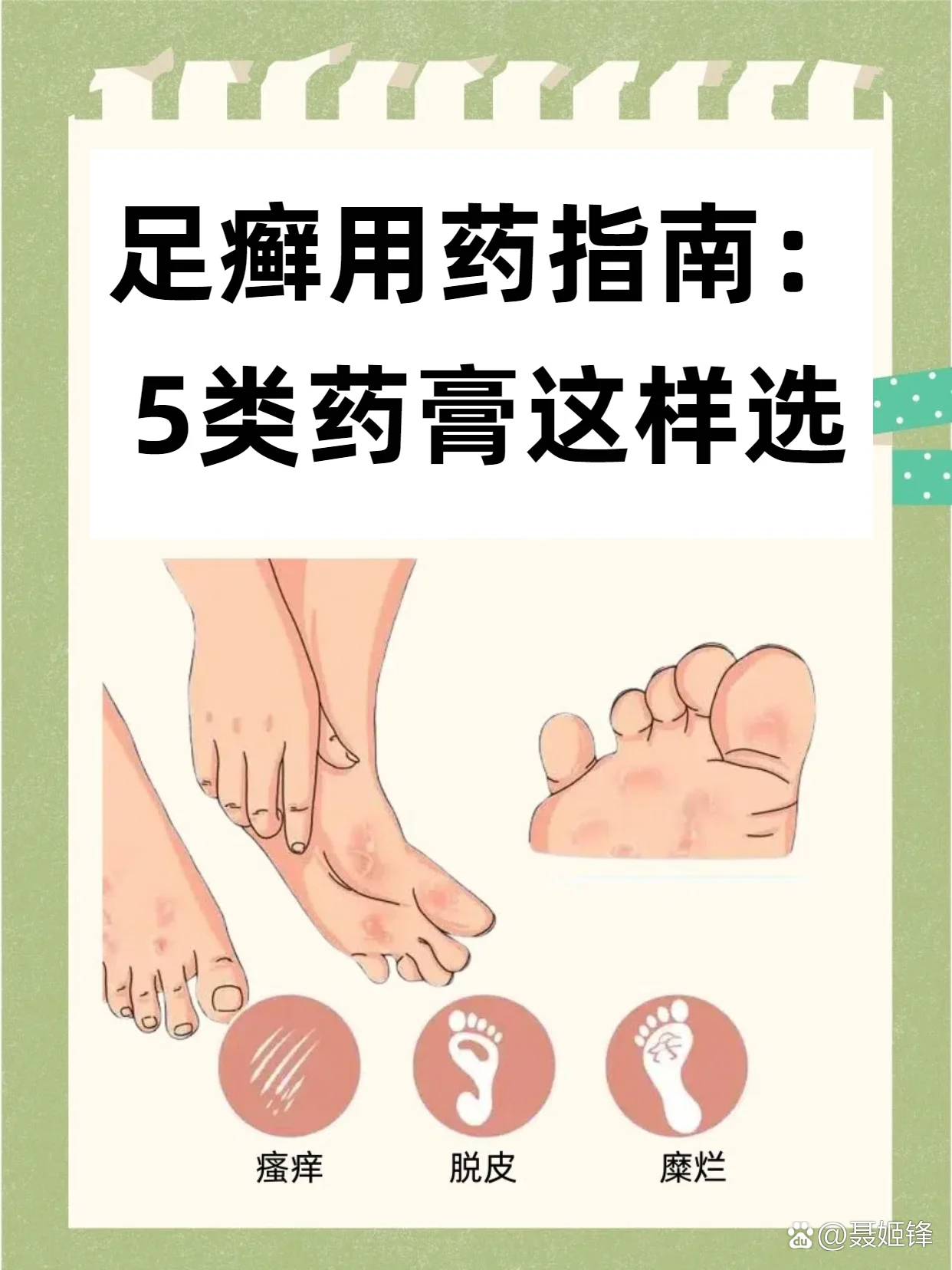 足部瘙痒预防常识