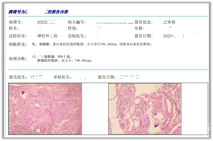 【病例分享】混合型脚气的成功治疗经验(图1) 【病例分享】混合型脚气的成功治疗经验