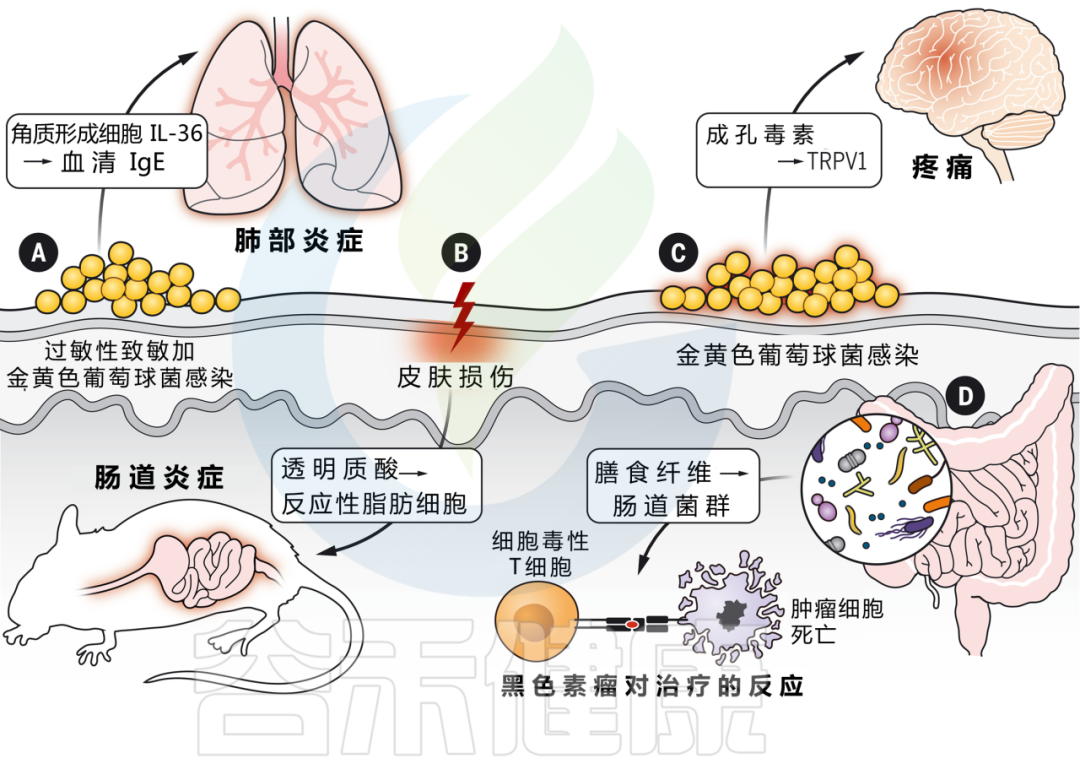 细菌型糜烂快速处理