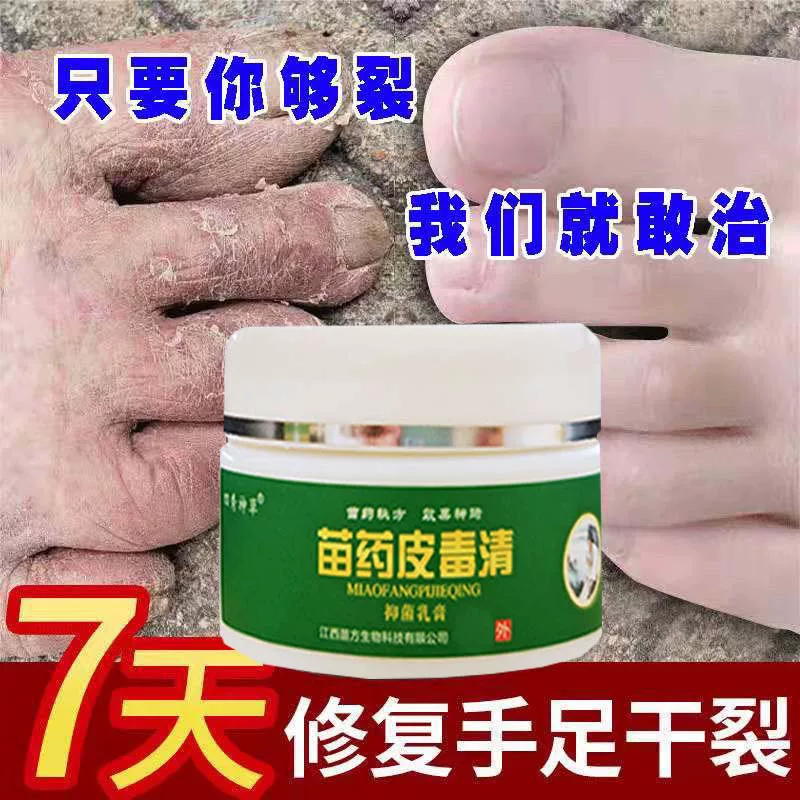 脚部糜烂专业快速修护