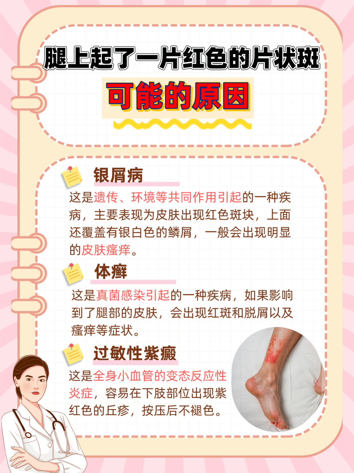 脚部红斑阴虚火旺诱发