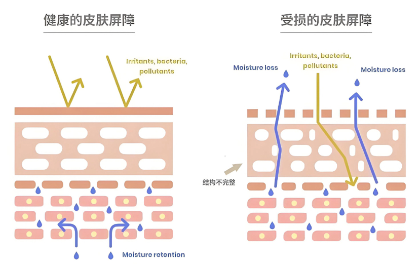 脚部糜烂皮肤屏障快速修复