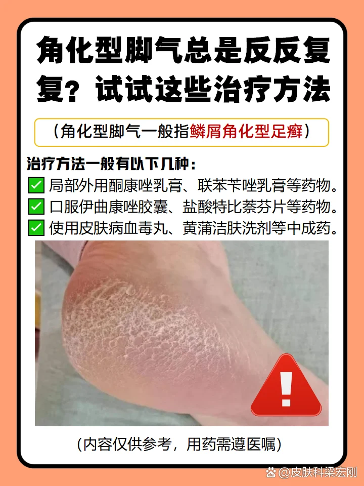 异味型脚气角质管理技巧(图1) 异味型脚气角质管理技巧