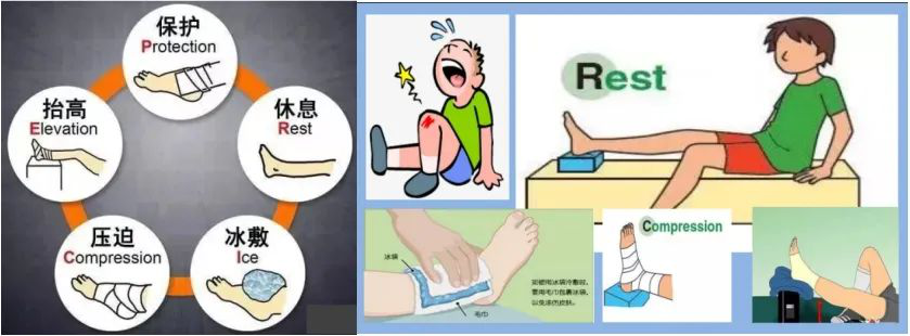 脚部糜烂避免二次损伤恢复(图1) 脚部糜烂避免二次损伤恢复