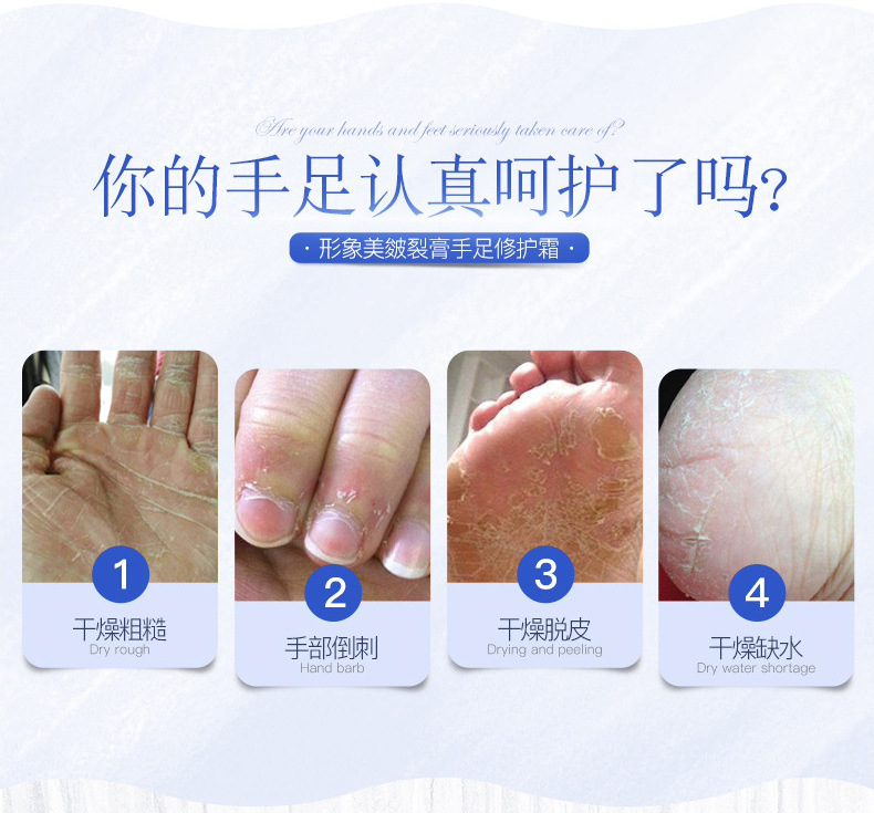 脚部糜烂涉水后快速修护(图1) 脚部糜烂涉水后快速修护