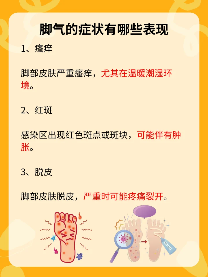 异味型脚气潜伏期筛查(图1) 异味型脚气潜伏期筛查