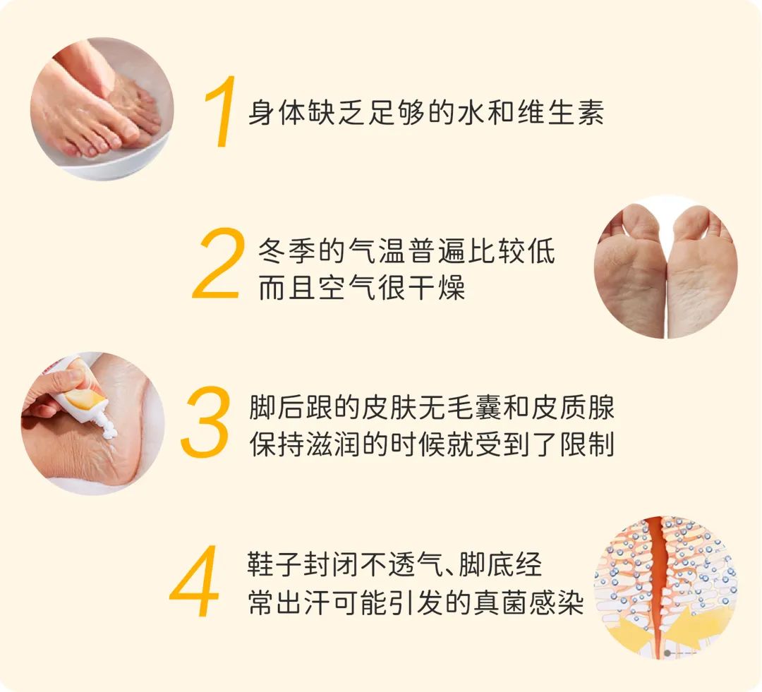 改善洗护残留脚脱皮