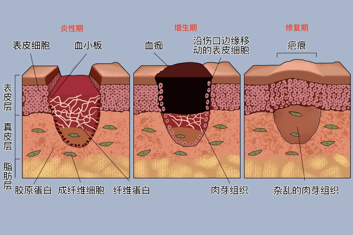 改善外伤愈合后脱皮