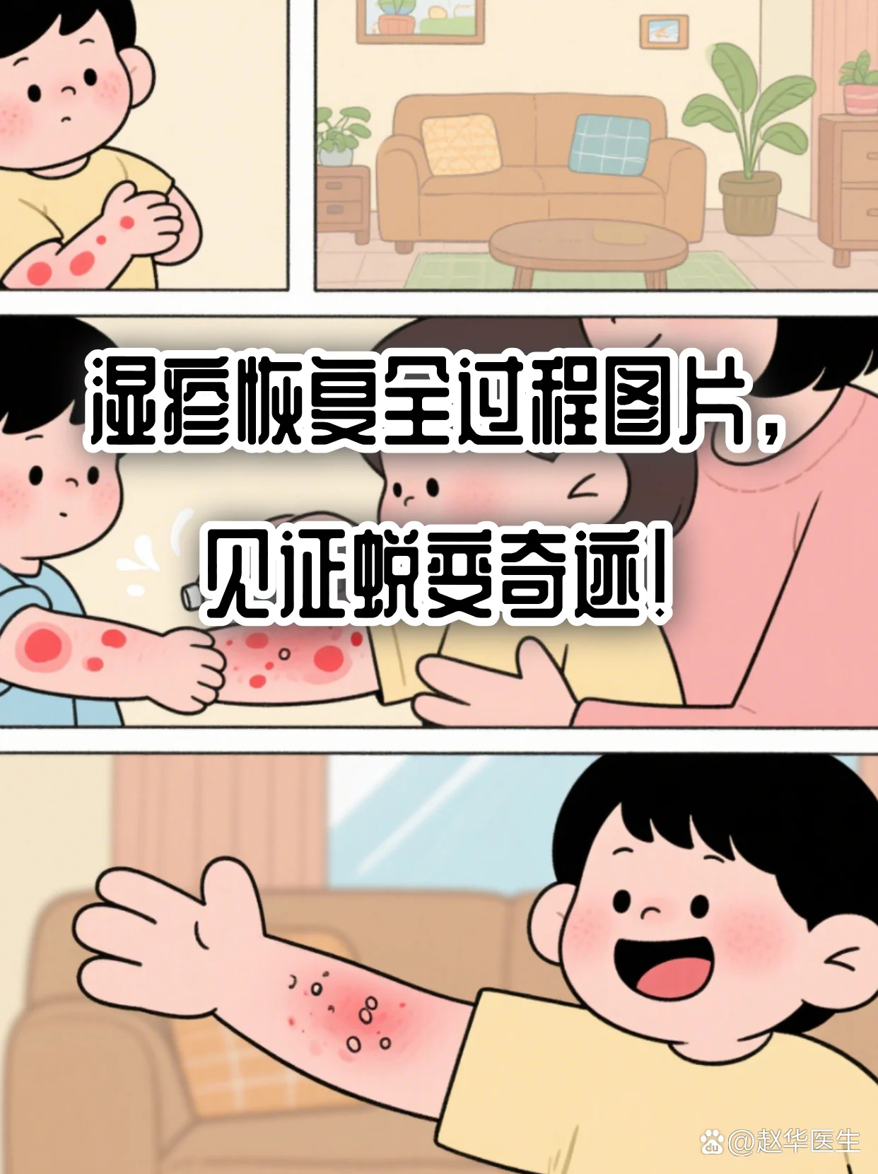改善湿疹恢复期脱皮
