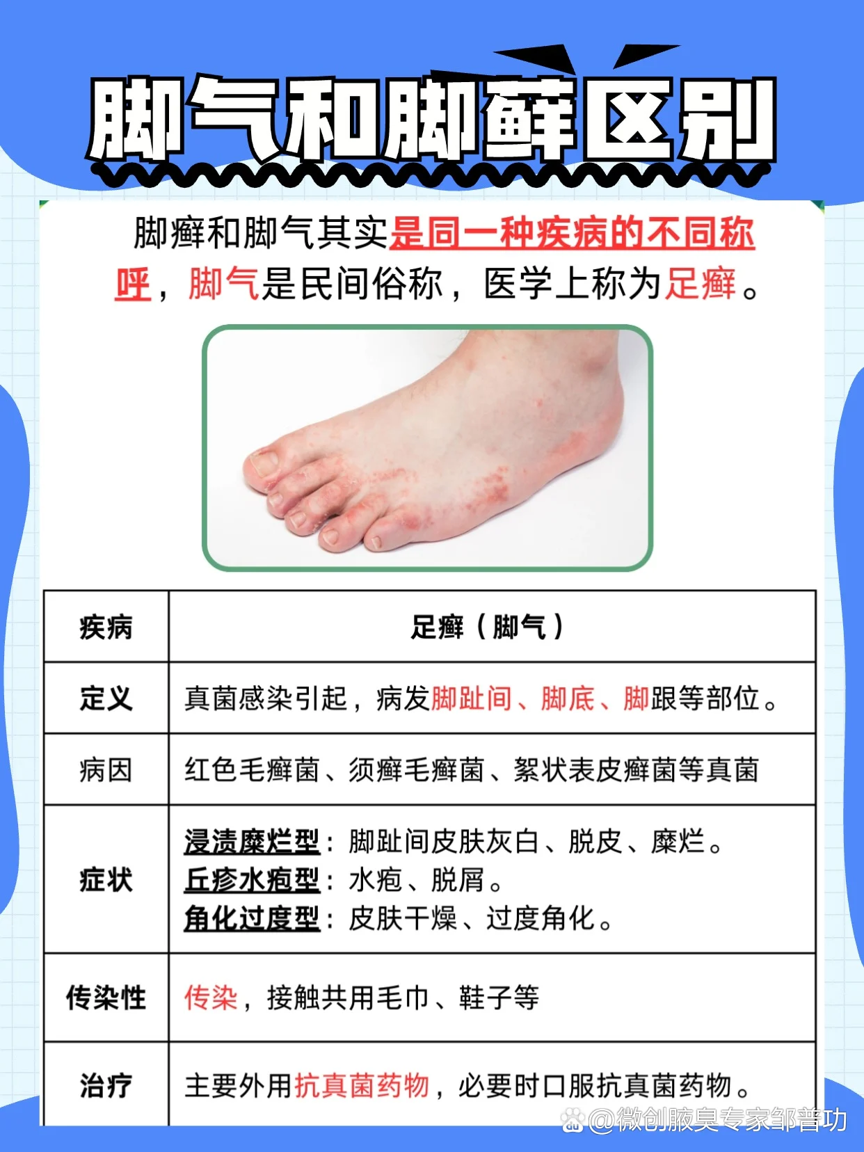 红斑型脚气抑菌频次