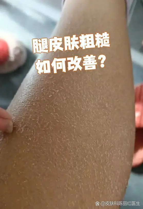 改善脚部粗糙肤质