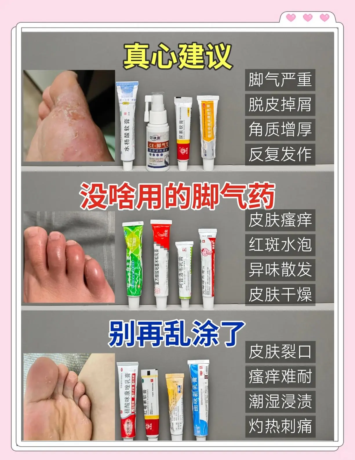 脚部红斑抗炎药膏选择