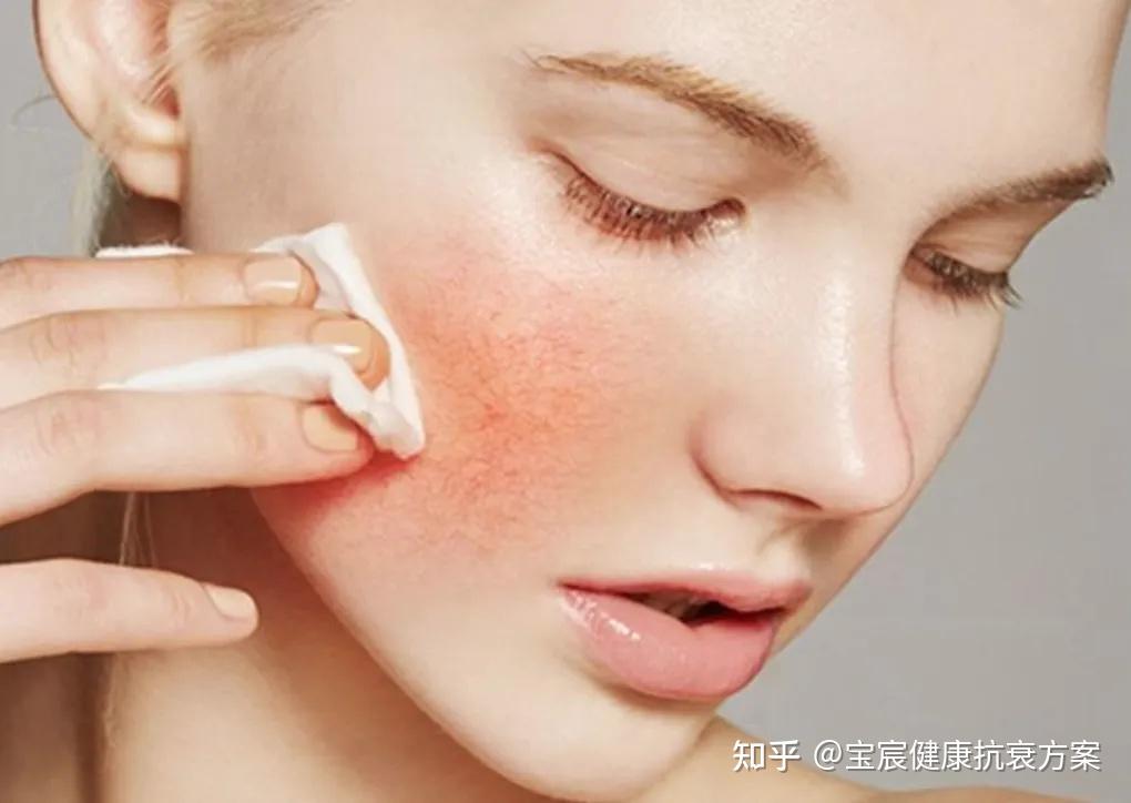 矿物成分舒缓脱皮不适