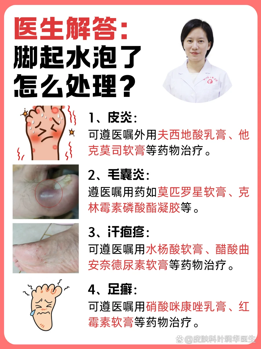 脚部水疱冻伤水泡舒缓