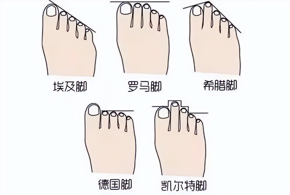 脚趾红斑治疗方法