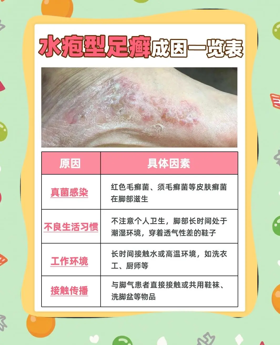 水疱型脚气久坐定时透气