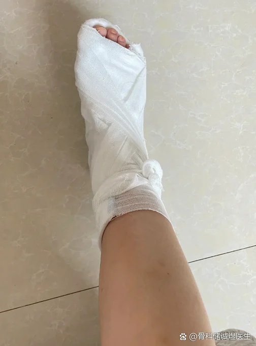 脚部水疱鞋带紧绷脚背受压(图1) 脚部水疱鞋带紧绷脚背受压
