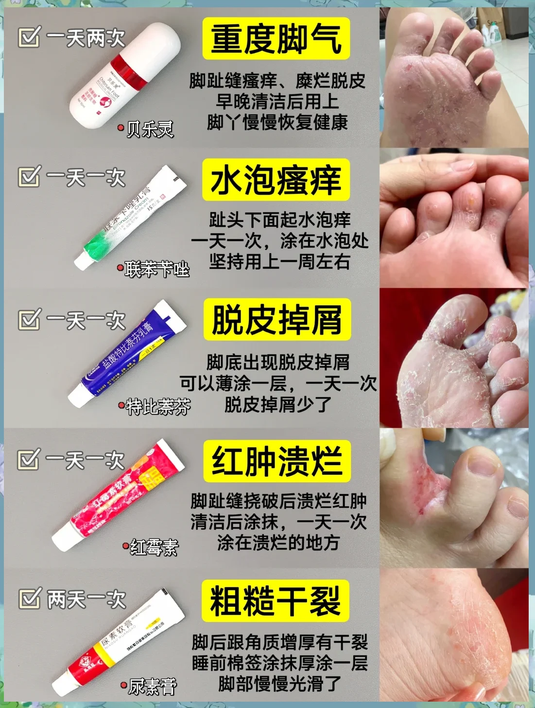 异味型脚气愈后断护快速复发