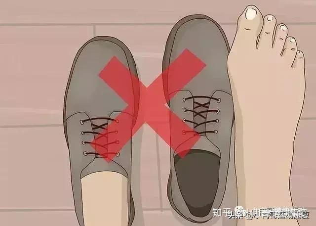 避免长期穿鞋封闭闷脚