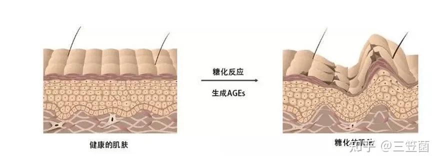 表皮加固减少起皮脱落