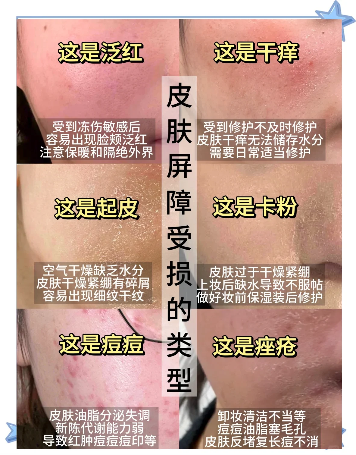 油脂调理防止干燥起皮