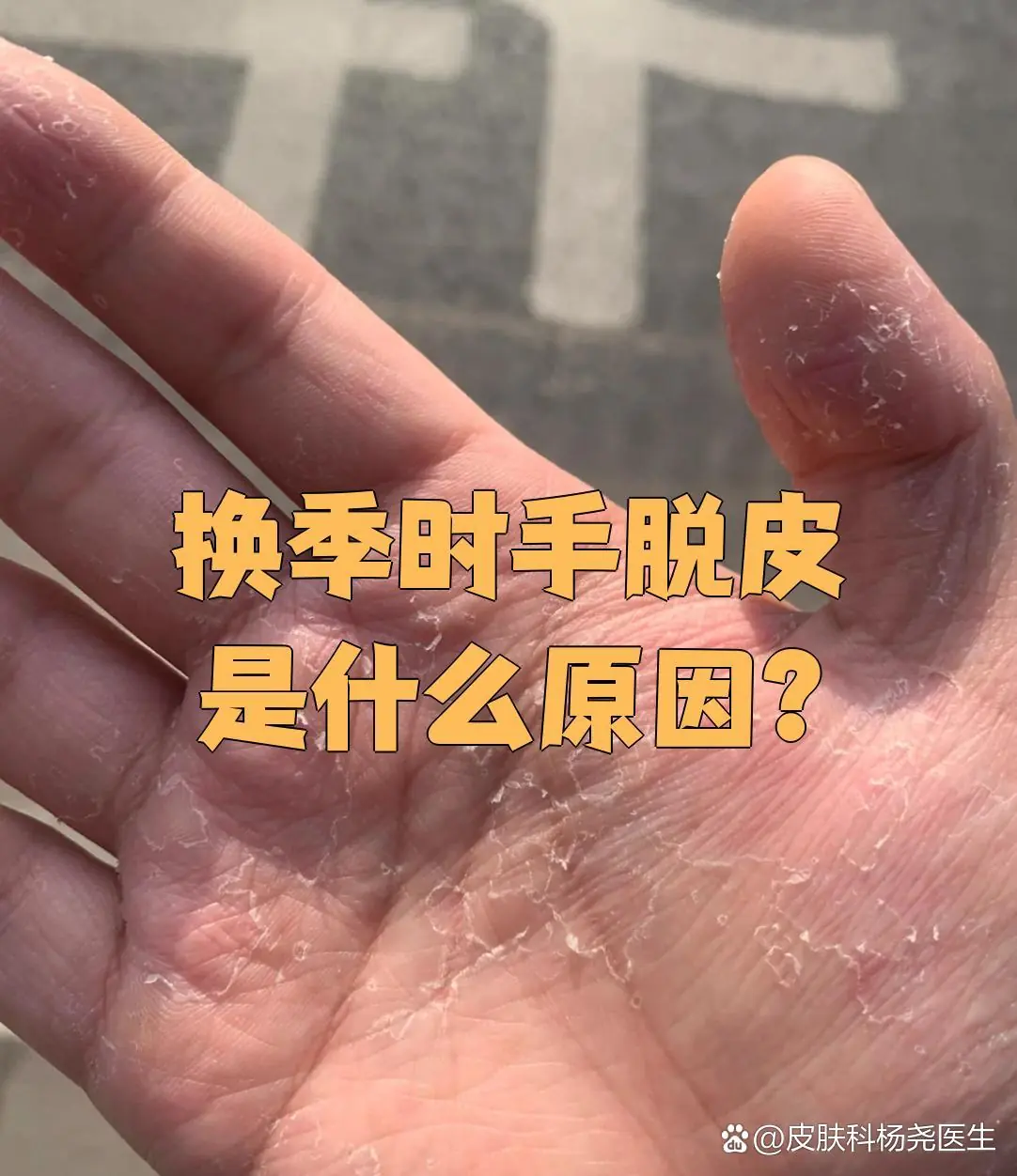 环境适应减少换季脱皮